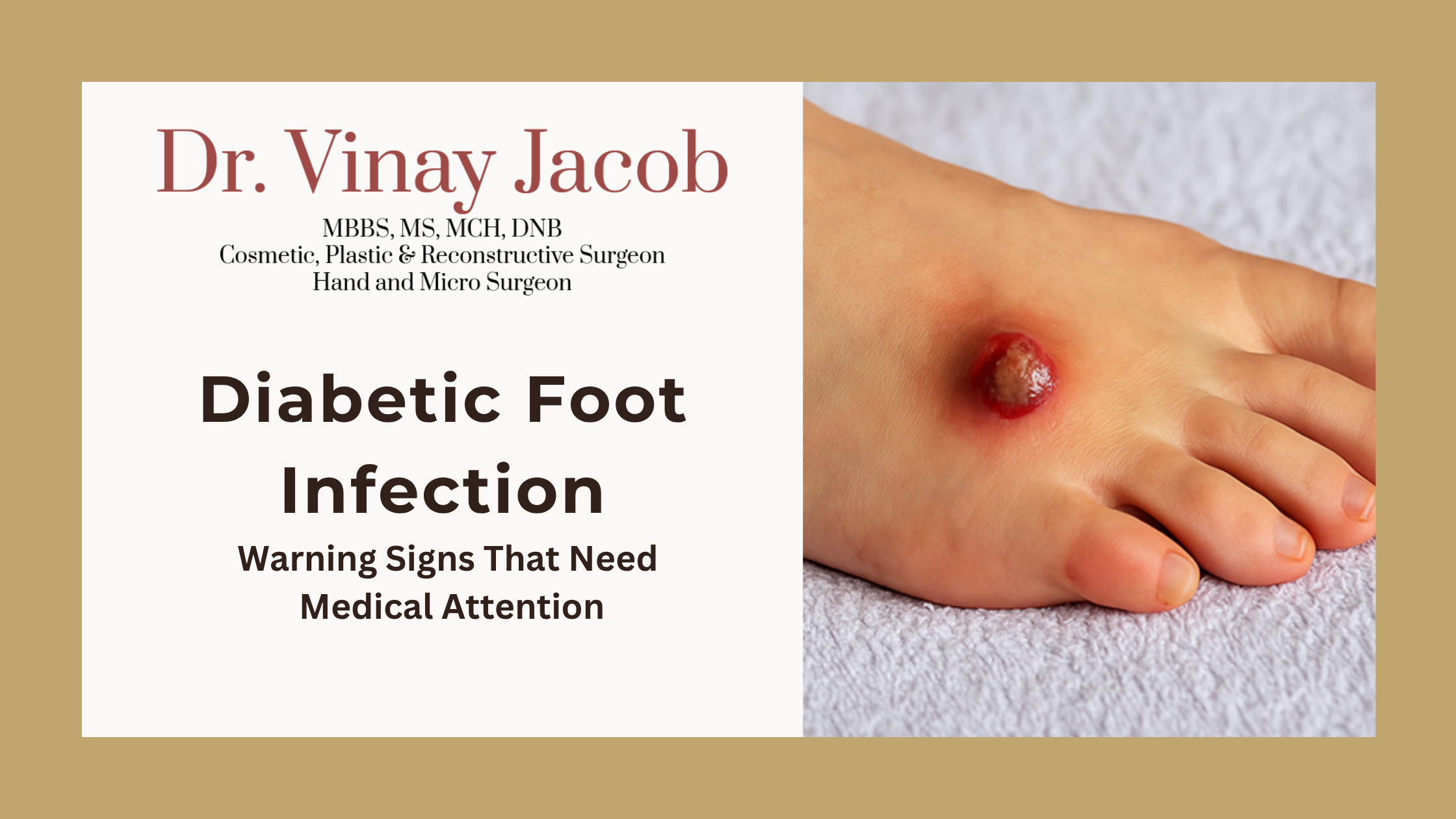 Diabetic Foot Infection: Warning Signs That Need Medical Attention